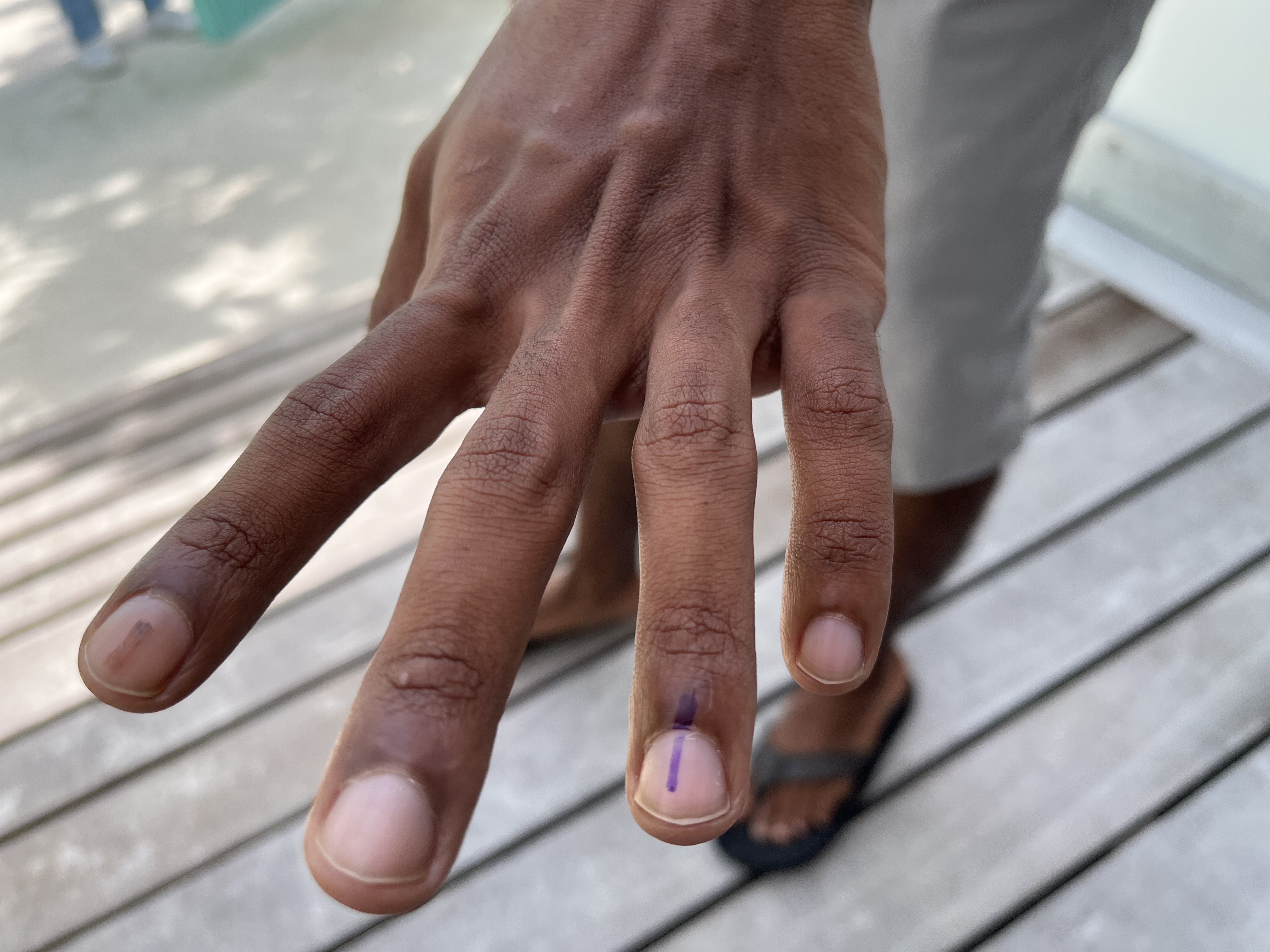 A voter shows finger dyed with election ink after casting their vote in the presidential elections in Maldives